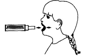 simptomy-bronhialnoj-astmy-11
